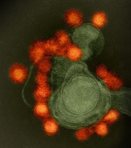 zika virus linked to microcephaly